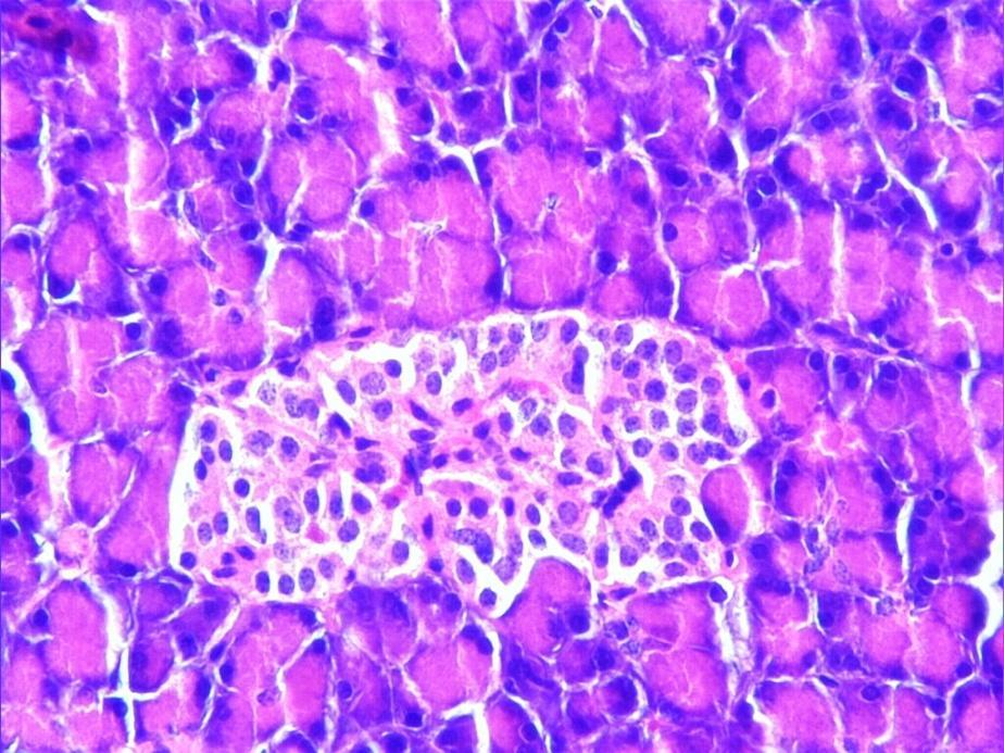 4.1.4. Diyabet + Quercetin grubu Langerhans adacıklarında, diyabet grubunda izlenen dev nukleuslu hücrelere rastlanmadı (Resim 26). H-E; X40. Resim 26.