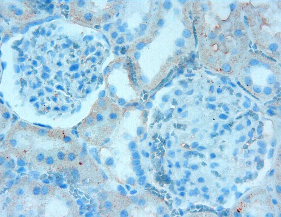 TGF-β1 immun boyama metodu uygulanan kesitlerde, tubuller zayıf immunopozitif reaksiyon gösterdi (Resim 32). T T çekmekte. TGF-β1; X40. Resim 32.