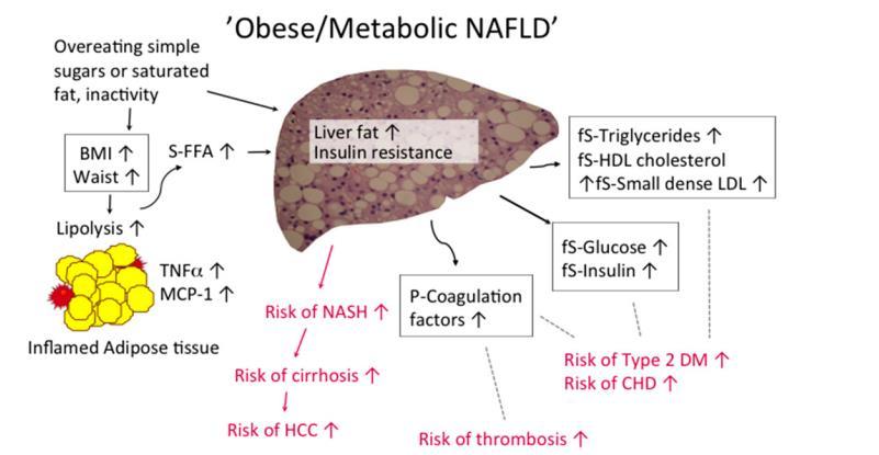 Obez/Metabolik NAYKH TM6SF2