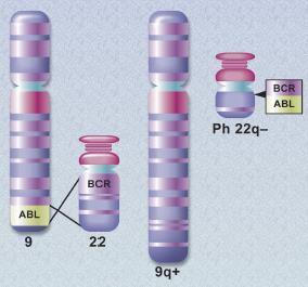Şekil 2.1: BCR ve ABL genlerinin translasyonu ve Ph kromozomu (38) 2.1.2 BCR-ABL GENİNİN OLUŞUMU VE YAPISI: KML yi tanımlayan BCR-ABL geninin oluşumu, 9.kromozomdaki ABL geninin 22.