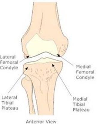 Tibia plato kırığının atlanması Diz ekleminin alt yüzeyini oluşturan tibianın proksimal bölümüne Tibia Plato denir.