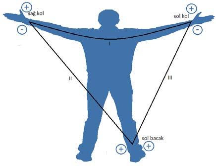 Einthoven yasası ile iki lead (yol) bilinirse 3. Lead (yol) hesaplanabilir. Bu husus, tasarımın uygulanmasında önemlidir.