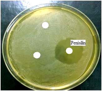 suşunun penisilin duyarlılığı Resim