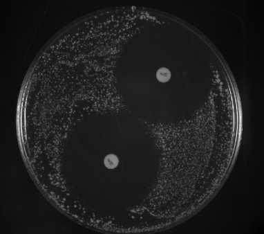 Çalışmada kullanılan 25 adet LAB kültürlerinin hepsinin Kanamycin (K30) antibiyotiğine karşı dayanıklı olduğu ve direnç gösterdiği