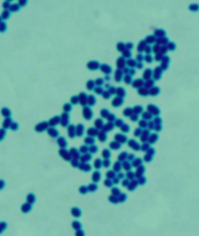 Endokardit şüphesi olmayan ve kritik olmayan hastalarda enterokokkal bakteriyemi monoterapi ile tedavi edilebilir Graninger W et al.