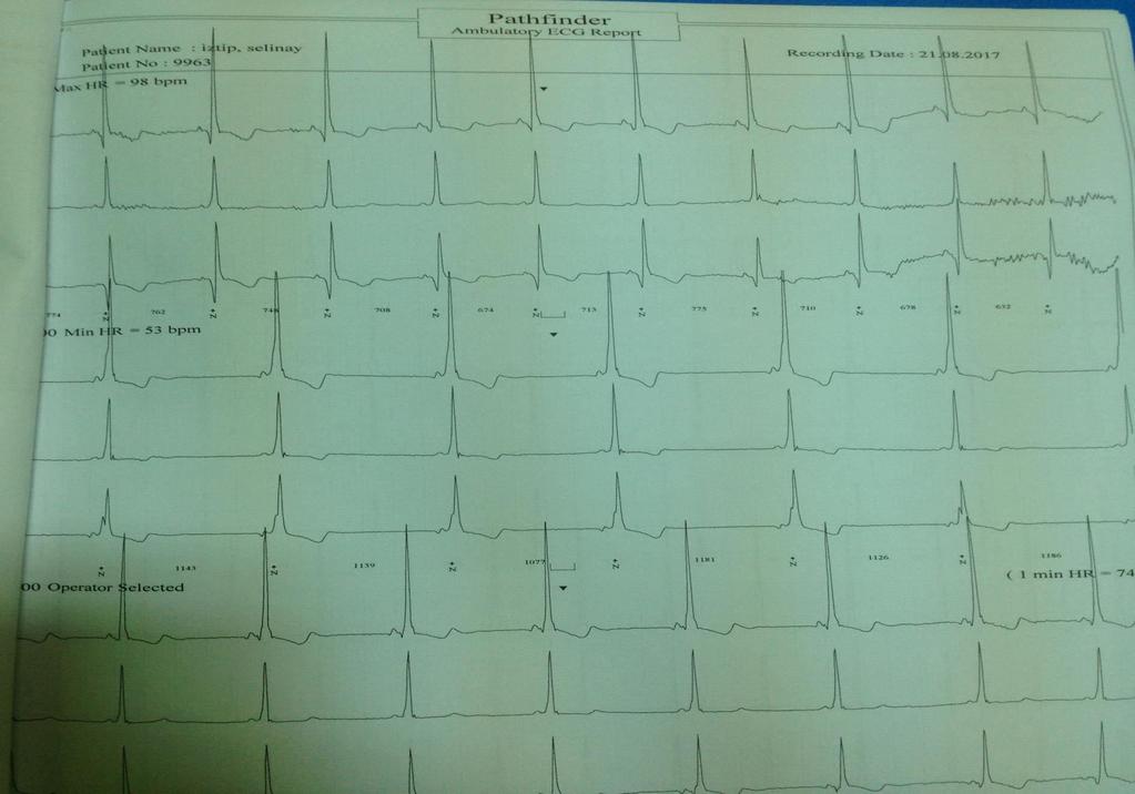 HOLTER-