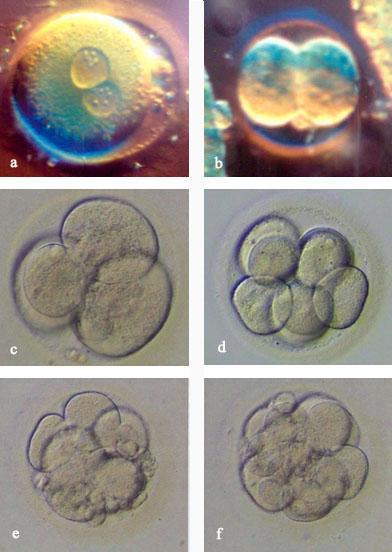 Transfer edilecek embryolar bu sınıflandırmadaki morfolojik özelliklere göre seçilmiştir. Embryo transferi Swemed (Vitrolife, İsveç) kateter kullanılarak ultrason eşliğinde yapılmıştır.