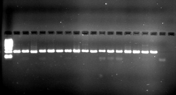 DNA ladder (uzunluk ölçer, bp=bç ) Şekil 4.