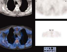 Fellowship of Postgraduate Medicine Patel C