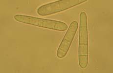 macrodidymum un SNA ve OA