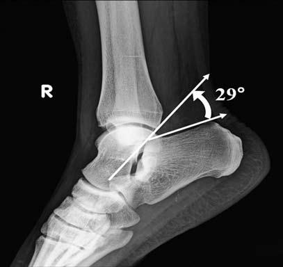 408 Acta Orthop Traumatol Turc Tablo 1.