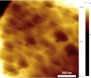 genişliği 4.5 kat artmış ve ortalama 40±5.4 nm olarak hesaplanmıştır.