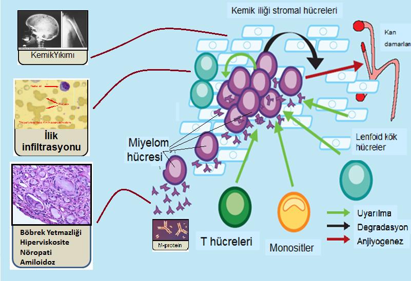 Plasma Hücresi