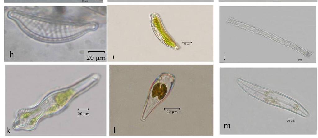 elongatum g) Diploneis subconstricta h) Epithemia sorex ı) Epithemia zebra j)