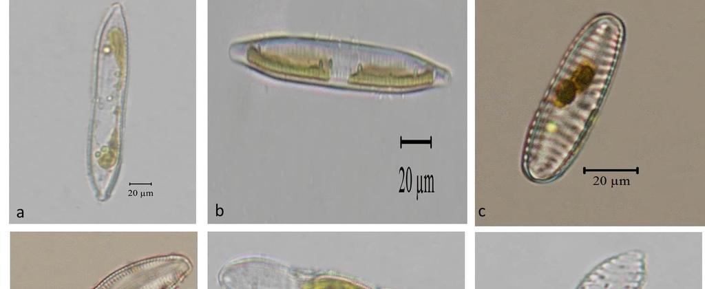 205 Şekil 9.5. a) Nitzschia palea b) Nitzschia