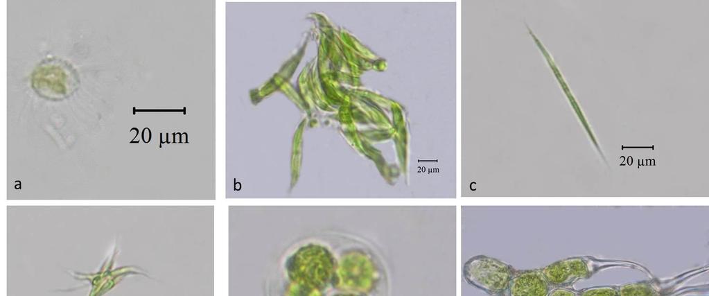 210 Şekil 9.10. a) Acanthosphaera zachariasii b) Ankistrodesmus