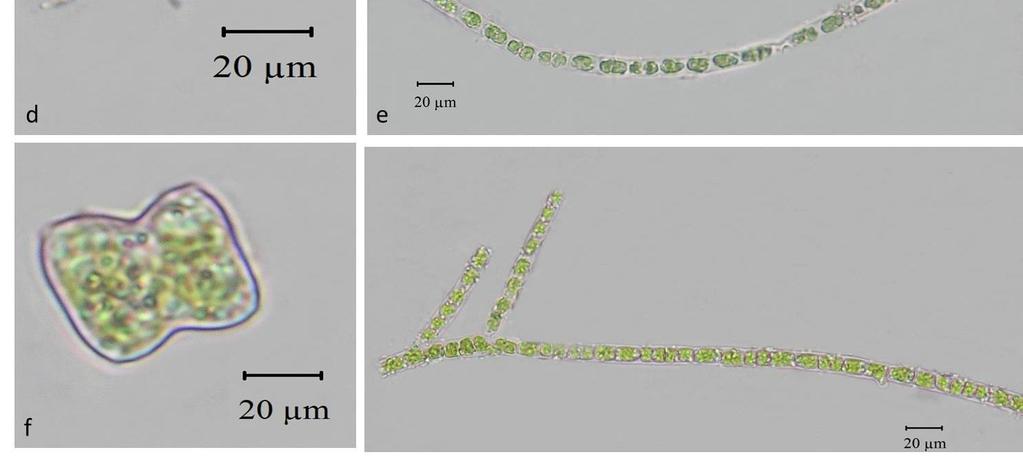 astroideumcatus c) Coelastrum microporum d)