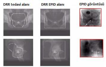 19 Şekil 2-18 Tedavi alanının yerini doğrulamak için DRR ve EPID görüntüsü İlk EPG cihazları 1980 lerin başında görüntülerin Norman Baily tarafından floroskopik sistem kullanarak alınması ile gündeme