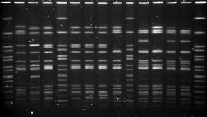 Moleküler Epidemiyoloji Bugün için ise moleküler epidemiyoloji terimi; genellikle moleküler