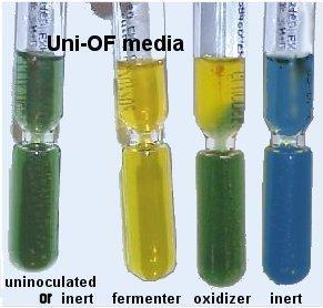 OF TESTİ Mikroorganizmaların karbonhidratları özellikle glikozu ayrıştırmada oksidatif veya fermentatif metabolik yolu kullanma durumlarını saptamada işe yarar ve ayrıca identifikasyonda yararlanılır.