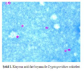 bu enfeksiyonun tanısında çeşitli acidfast