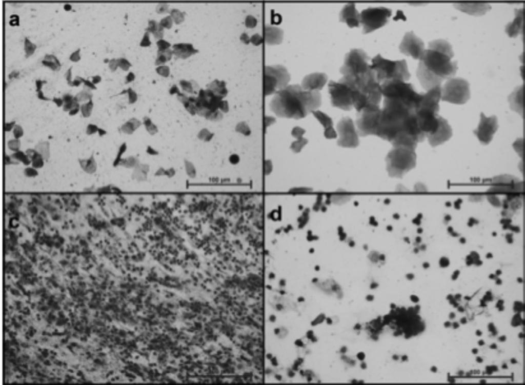 anti-mouse (PLIN3, dilüsyon 1:100, Progen) primer antikorları ile bir gece +4 C de inkübe edildi.