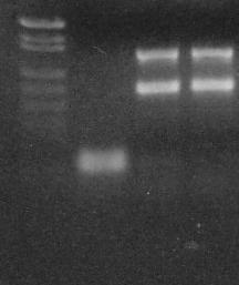 1 2 3 4 Figür 1: %3 Agaroz jel elektroforezi 1. DNA MW Markır 2. Negatif kontrol 3.ve 4. H.