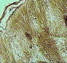 epitelyaliste gastrin IR hücreler, PAP X 400 oklar Şekil 5. Orta bağırsakta L.