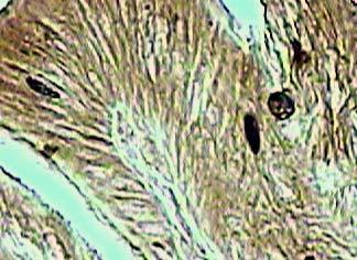 epitelyaliste gastrin IR hücreler, PAP X 200 ok Şekil 7.