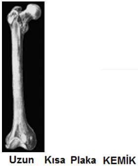 Fratzl ve Weinkamer in 2007 de Şekil 17 de tanımladığı gibi üç tip farklı geometrik kemik yapısı vardır; Uzun kemikler, kısa kemikler, plaka benzeri kemikler.