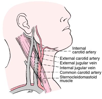 Şekil 3. Eksternal Juguler Ven Anatomisi Femoral ven: Femoral ven en geniş, kateterize edilmesi en kolay fakat sorunlu bir vendir.