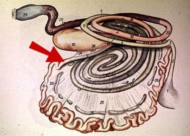 PATOGENEZ ileum yangı intestinal duvarda