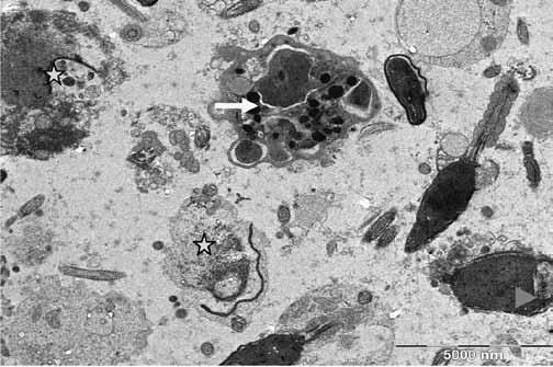 Derleme Şekil 4: Ultrastrüktürel apoptotik sperm (*): Nekrotik sperm ( ): (Apoptotik cisimcikler - nükleer fragmantasyon) Apoptotik sperm (Δ): Spermde Nükleer vakuol (Yayınlanmamış data) den