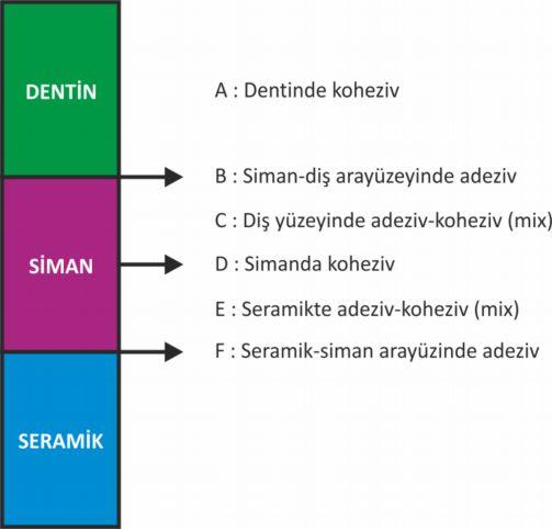 koheziv (mix ) F : Seramik-siman ara yüzeyinde adeziv detaylandırılmıştır (Şekil 1.2). kırık şeklinde Şekil 1.2. Kırık yüzey analiz sınıflamasının şematik gösterimi Hikita ve ark (2007). 1.9.3.