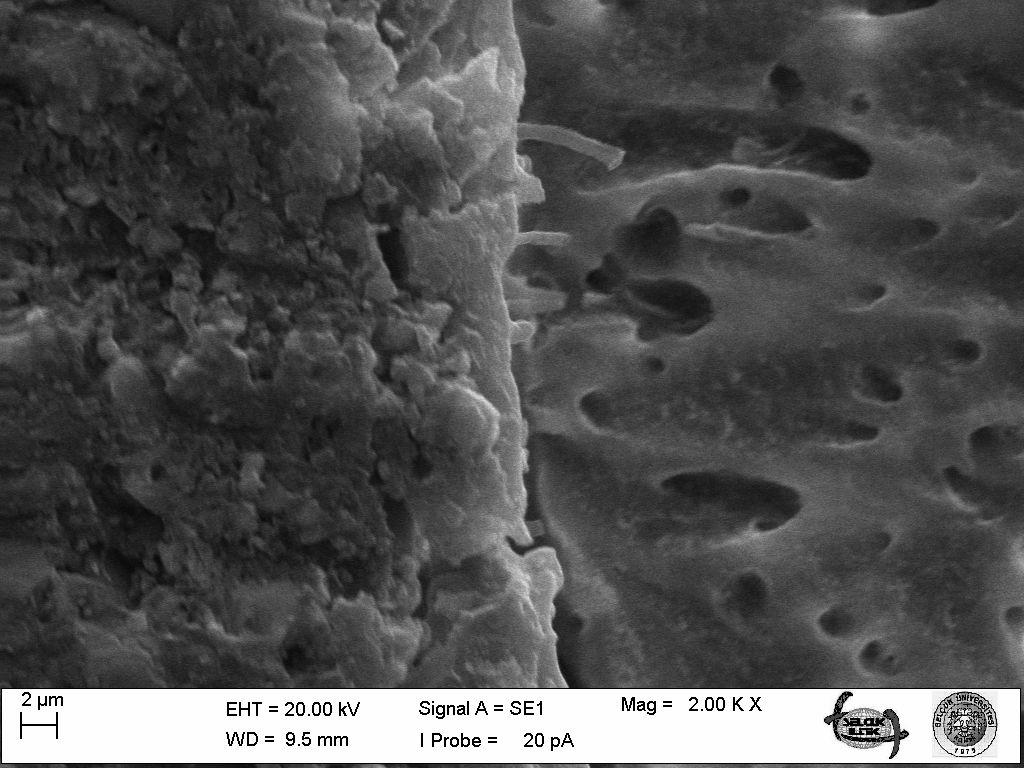 RT S HT RS Resim 3.6. Panavia F 2.0 rezin siman grubunun rezin-dentin ara yüzünün SEM (x 2000 büyütme). (S: Seramik, RS: Rezin Siman, HT: Hibrit Tabaka, RT: Rezin Tag) 3.3.4.