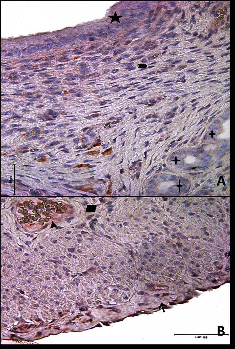 Resim 14A,B: Gebe olmayan, diyabetli ve yaşlı gruba ait uterus dokusunda tip4 kollajen boyamasında epitel, bez