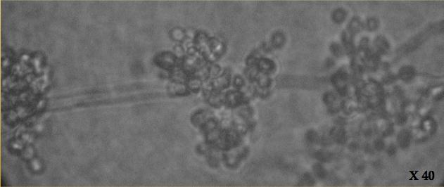 engellenmiş ancak 25 µg/ml konsantrasyon da bu etki gözlenmemiştir. Şekil 4.5 ve 4.6 da 25 µg/ml konsantrasyonda ZL 3 B nin C. albicans ATCC 90028 ve C.