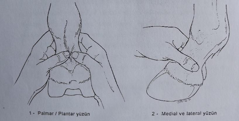 Şekil 11. Bukağılık bölgesinin muayenesi (Adams tan) -Bukağılık çukurluğunda; iki elin başparmağı ile yapılan basınç sonu m.