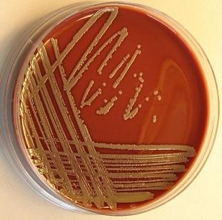 popülasyonda S. aureus için sürekli taşıyıcılık oranı %20 dir. Popülasyonun %30 kadarı aralıklı taşıyıcıdır, %50 si ise S. aureus taşıyıcısı değildir 34,35,36. S. aureus toplum kökenli sepsisin en önemli nedenidir.