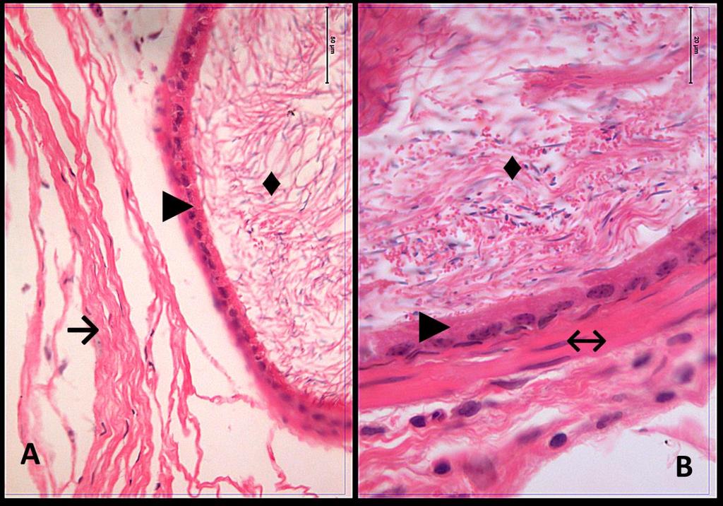 Resimler: Resim 1A,B:Kontrol grubu duktus epididimis dokusuna ait kesitlerde; yalancı çok katlı epitel ( ),
