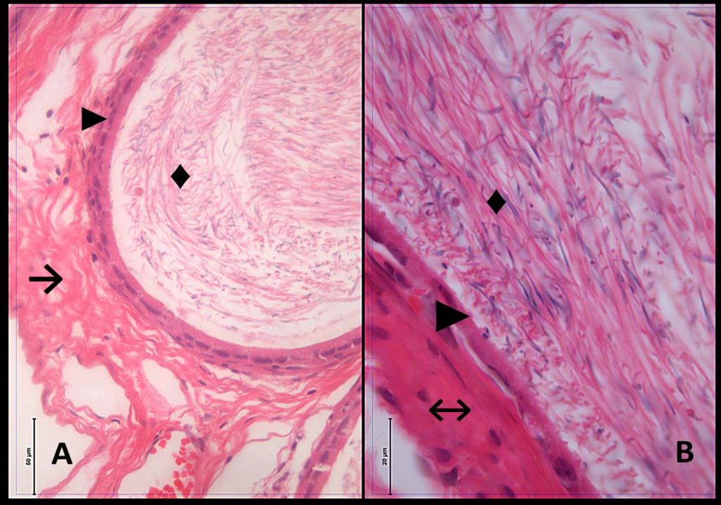 Resim 3A,B: Melatonin grubu duktus epididimis dokusuna ait kesitlerde; yalancı çok katlı epitel ( ), spermiyum (