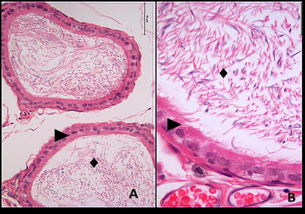 Resim 4A,B: Radyasyon + Melatonin grubu duktus epididimis dokusuna ait kesitlerde; yalancı