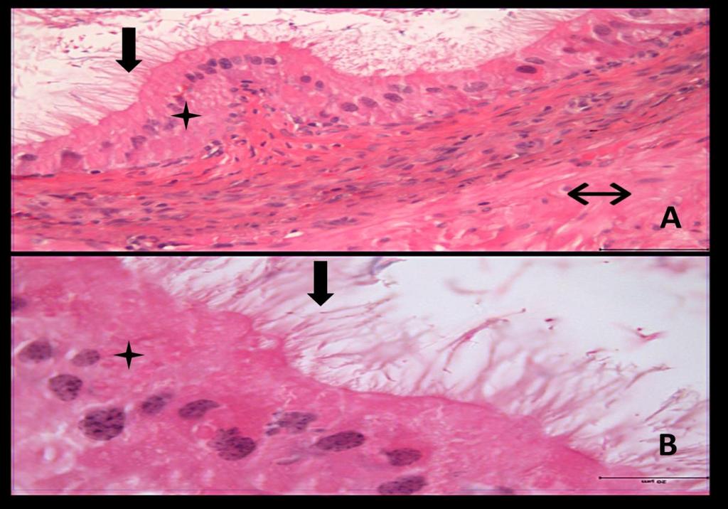 Resim 9A,B:Kontrol grubu duktus deferens dokusuna ait kesitlerde yalancı çok katlı prizmatik epitel