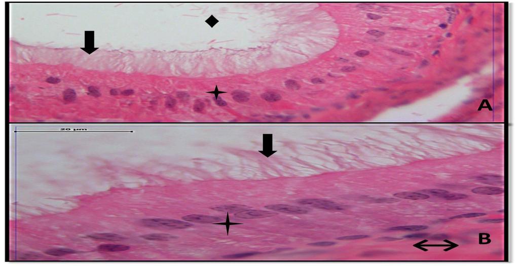 Resim 11A,B: Melatonin grubu duktus deferens dokusuna ait kesitlerde yalancı çok katlı prizmatik epitel (