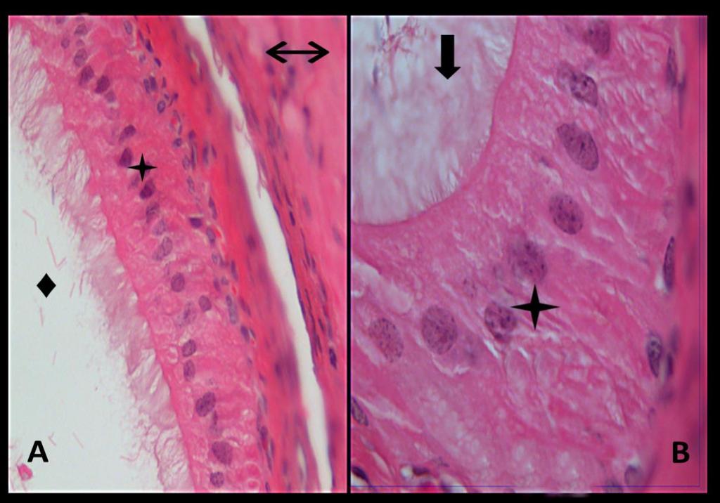 Resim 12A,B: Radyasyon + Melatonin grubu duktus deferens dokusuna ait kesitlerde yalancı çok katlı prizmatik