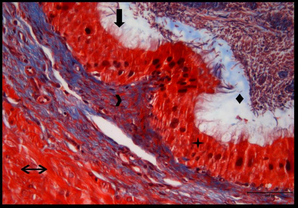 Resim 16: Radyasyon + Melatonin grubu duktus deferens dokusuna ait kesitlerde; yalancı çok katlı prizmatik epitel ( ),