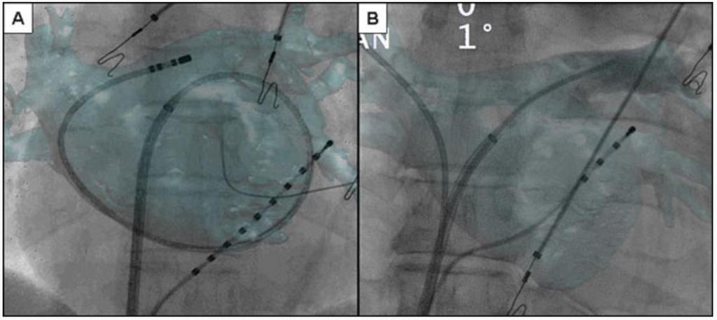 Knecht S, et al.