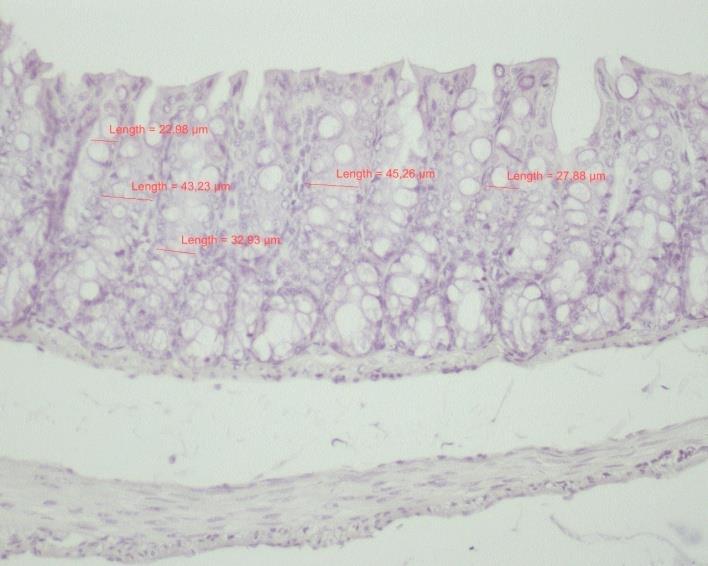 Kör farede yaptığımız ölçümlerle ortalama kolon kript derinliğini 236,01±21,68 µm, genişliğini 34,24±4,46 µm ve goblet hücre sayısını 11,85± 2,90 olarak bulduk.