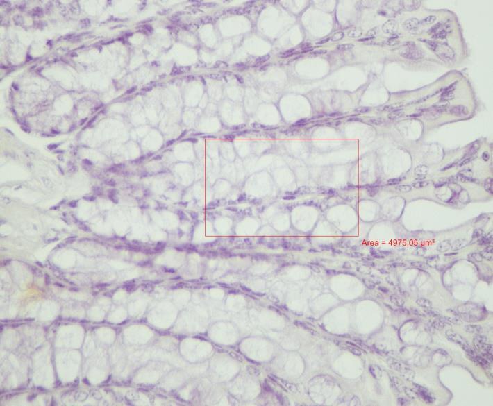 Şekil 3:Kör fare kolonunda goblet hücre sayımı. Orijinal Büyütme Χ40. Boya: : Hematoksilen Eozin, Orijinal Büyütme Χ20.
