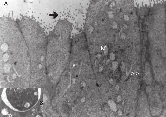 Bezler biçimlenmişti, bez hücre sitoplazmasında granüllü endoplazmik retikulum tubulusları, mitokondriyonlar ve serbest ribozomlar görülüyordu (Resim 2c) 7 haftalık grubun elektron mikroskop